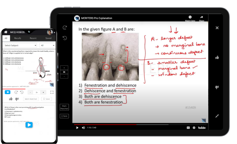 MCQ VIDEOS